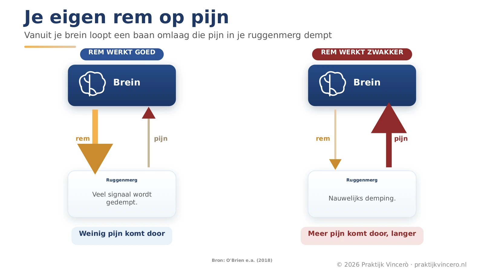 Schema met twee panelen: een rembaan vanuit het brein die pijn in het ruggenmerg dempt. Links werkt de rem goed en komt weinig pijn door, rechts werkt de rem zwakker en komt meer pijn door.