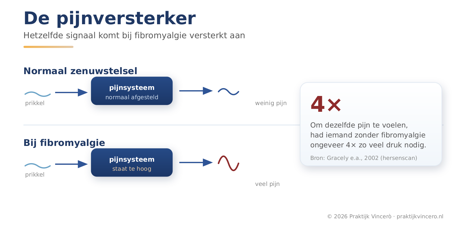Twee dezelfde prikkels, twee verschillende uitkomsten: bij een gewoon zenuwstelsel komt een lichte prikkel als een lichte pijn aan, bij fibromyalgie geeft het zenuwstelsel diezelfde prikkel te sterk door.